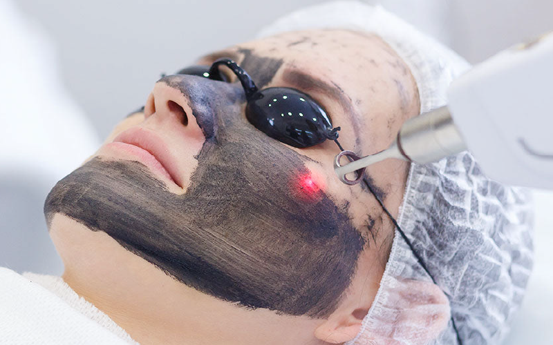 Facial Hollywood Peel